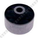 Buje-Puño-Tijera-Delantera-Tq-BUJE-TIJERA-G-STAREX-DEL---1